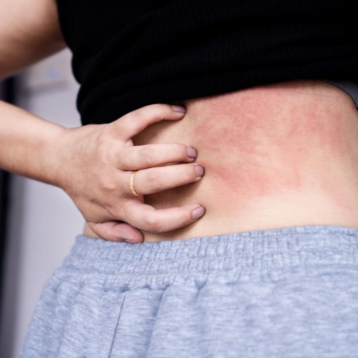 Forscher entdecken neues Symptom - darauf sollten Sie achten