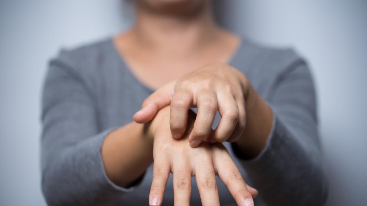 Zu den Symptomen der Affenpocken geh&ouml;rt unter anderem ein Ausschlag, der zun&auml;chst im Gesicht auftritt und dann vor allem H&auml;nde und F&uuml;&szlig;e betrifft. (Foto)