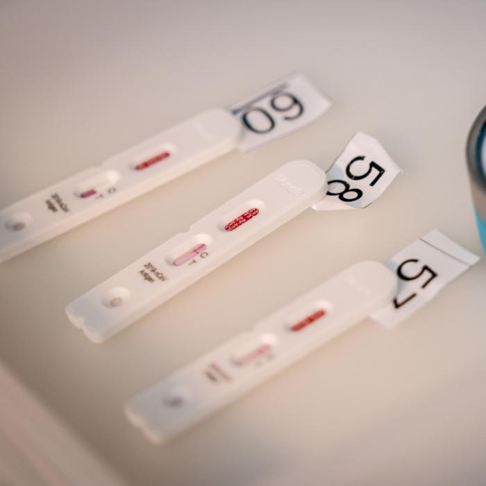Wann und wo gibt's Schnelltests - und was kosten sie?