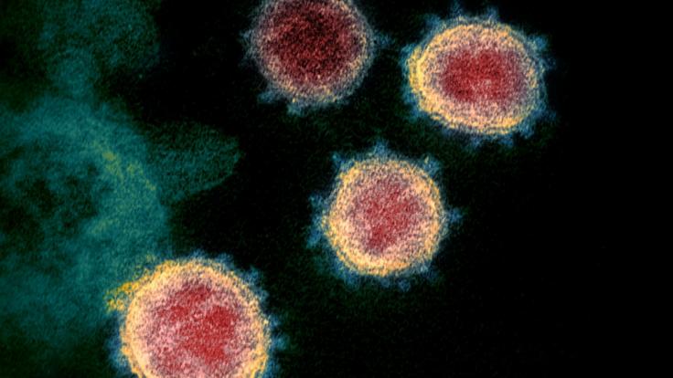 Aktuellen Studien zufolge steht das Coronavirus im Verdacht, das menschliche Nervensystem dauerhaft zu schädigen.