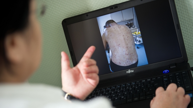 Die Obdachlosen-Ärztin Jenny De la Torre zeigt ein Foto auf ihrem Laptop von einem Patienten, der von Krätze befallen ist.