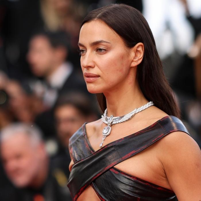 Höschen-Blitzer! Topmodel macht die Beine breit