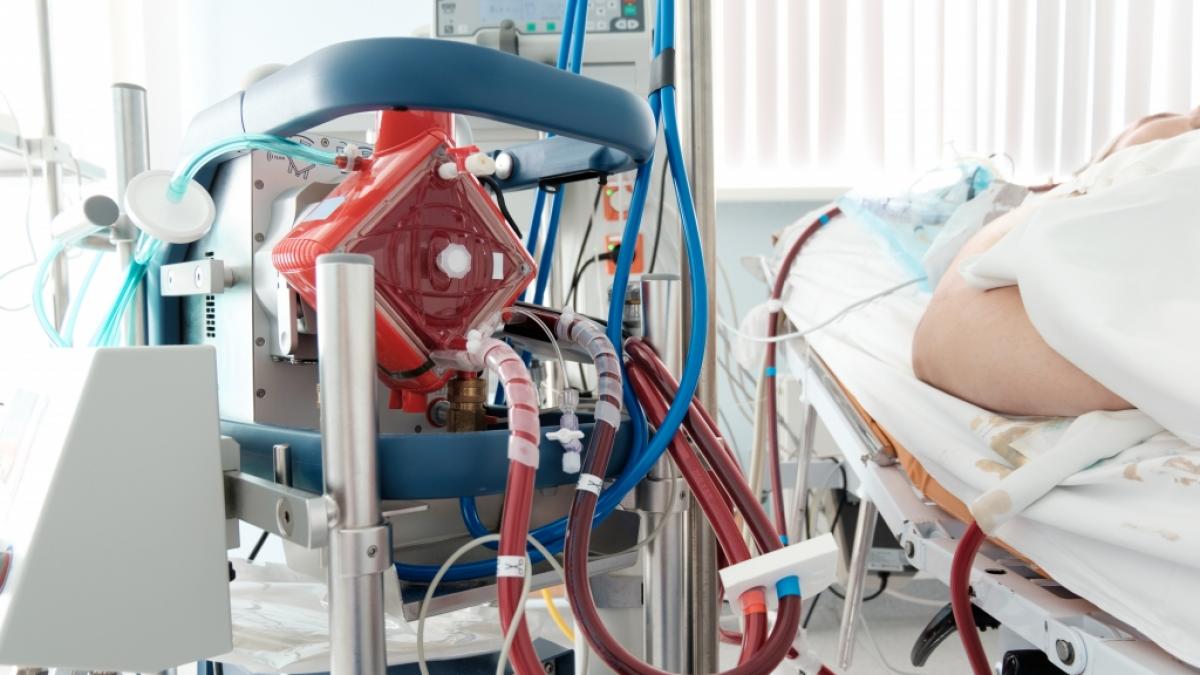 Ein Patient, der an die ECMO angeschlossen werden muss, kostet bis zu 92.000 Euro. (Foto)