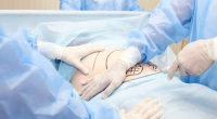 Eine 19-jährige Studentin starb nach einer Fettabsaugung. (Symbolfoto)