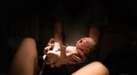 In Brasilien kam ein Baby mit einem Schwanz zur Welt.