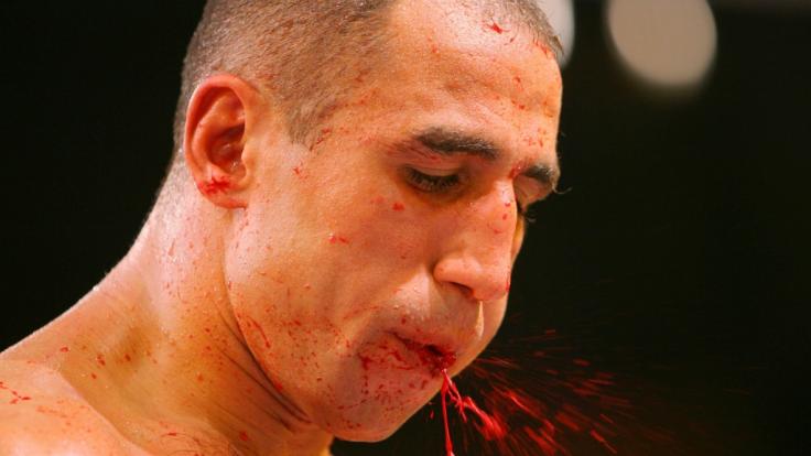 Arthur Abraham mit gebrochenem Unterkiefer in der Blutschlacht von Wetzlar