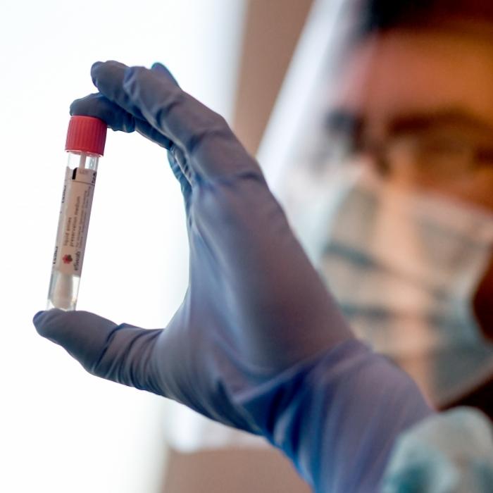 Infektionen und Todesfälle - News zum Coronavirus