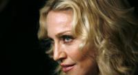 Madonna schockt ihre Fans mit einem bizarren Instagram-Foto.