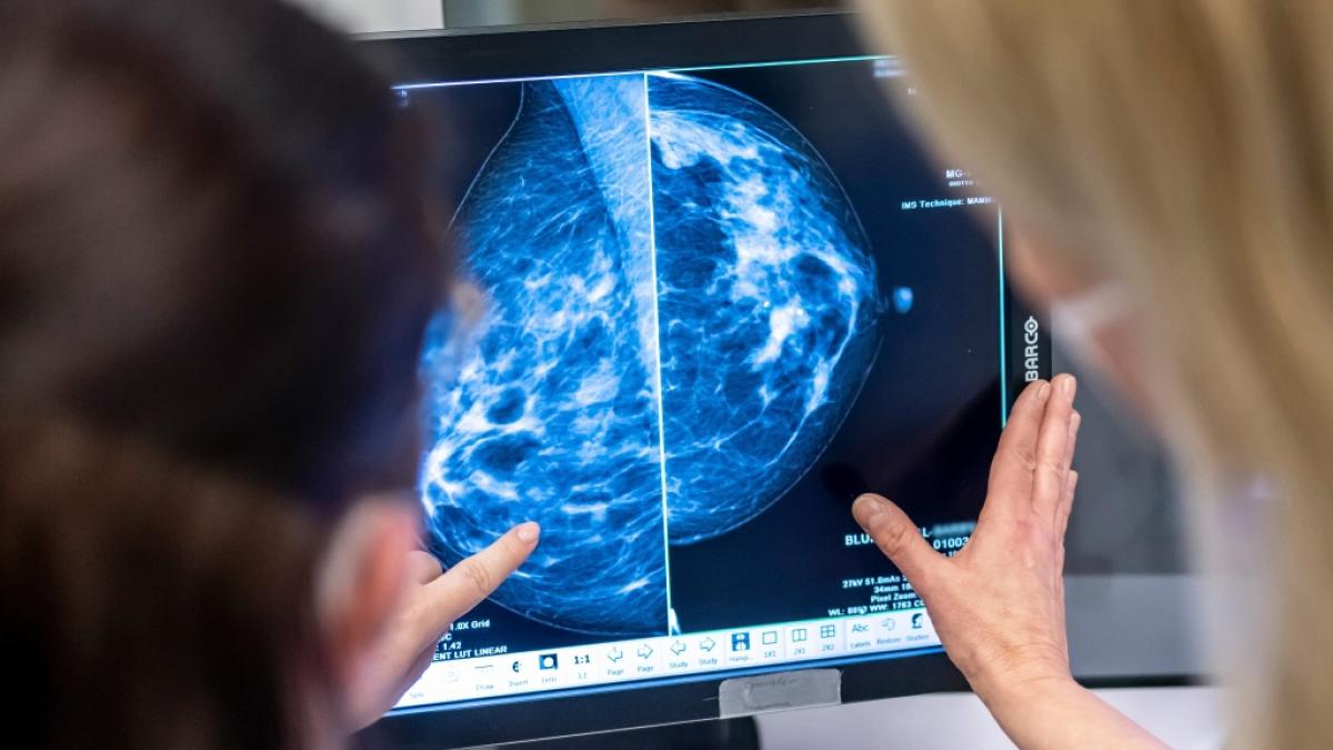 Brustkrebs ist die mit Abstand h&auml;ufigste Krebsart bei Frauen. (Foto)