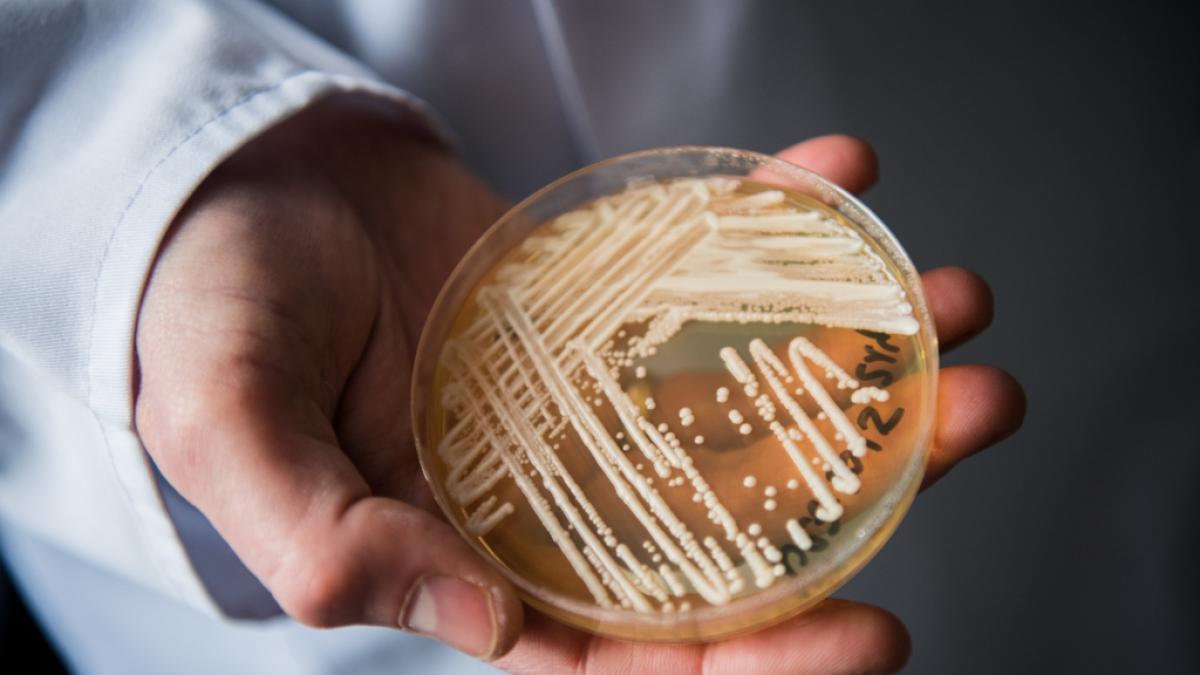 Der Leiter des Nationalen Referenzzentrums f&uuml;r invasive Pilzinfektionen, Oliver Kurzai, h&auml;lt eine Petrischale mit dem Hefepilz Candida auris in den H&auml;nden. (Foto)