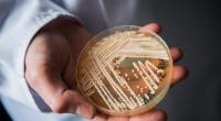Der Leiter des Nationalen Referenzzentrums für invasive Pilzinfektionen, Oliver Kurzai, hält eine Petrischale mit dem Hefepilz Candida auris in den Händen.