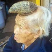 Dieser Chinesin wächst ein Horn aus dem Kopf.