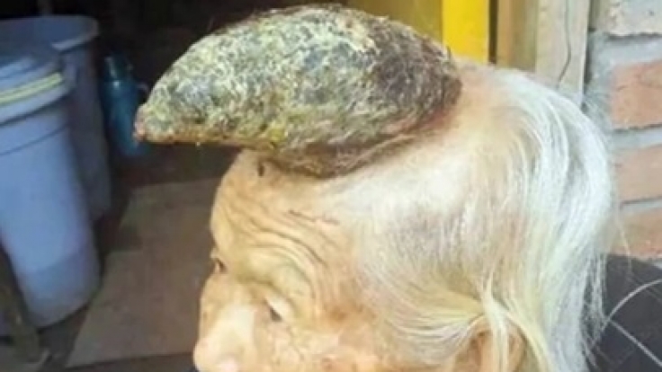 Dieser Chinesin wächst ein Horn aus dem Kopf.