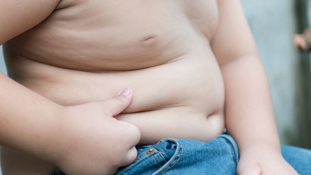 Der dickste Junge der Welt hat 89 Kilogramm abgenommen. (Symbolbild) (Foto)