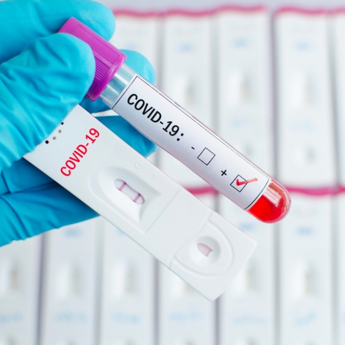 Forscher warnen: Trotz Immunität drohen hohe Gesundheitsrisiken