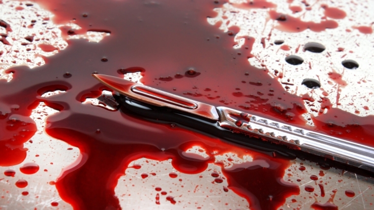 In Indiana, USA, ermordete ein Mann seine Ex-Freundin und aß Teile ihrer Leiche.