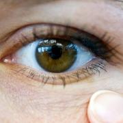 Mit offenen Augen durchs Leben gehen: Viele Betroffene müssen damit nach einer verpatzten Lidkorrektur leben.
