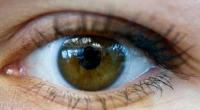 Mit offenen Augen durchs Leben gehen: Viele Betroffene müssen damit nach einer verpatzten Lidkorrektur leben.