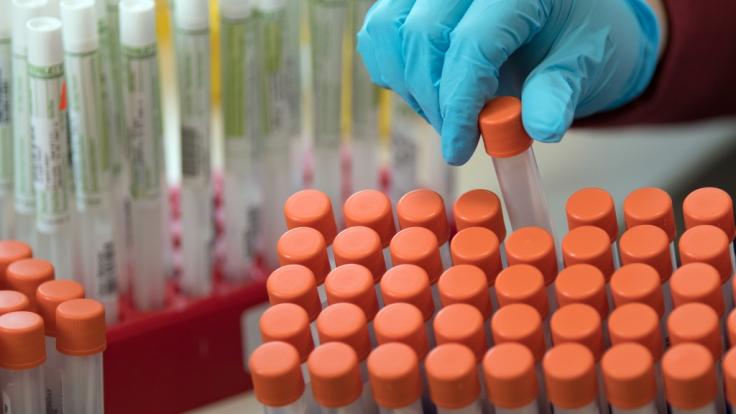 Bringt die Covid-19-Mutation den Corona-Impfstoff in Gefahr?