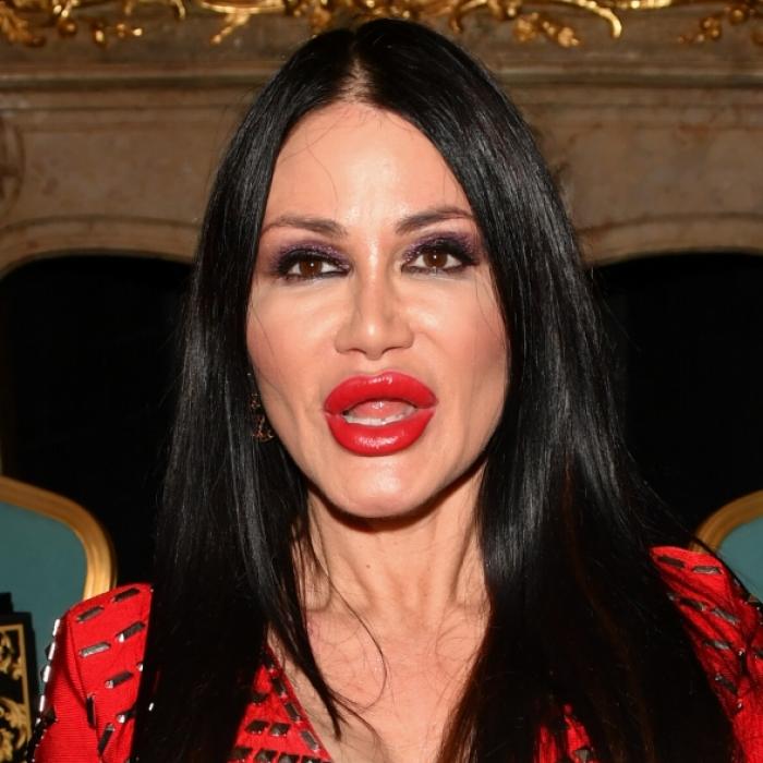 Ex-Dschungelkönigin nicht wiederzuerkennen - neue Lippen, neuer Look