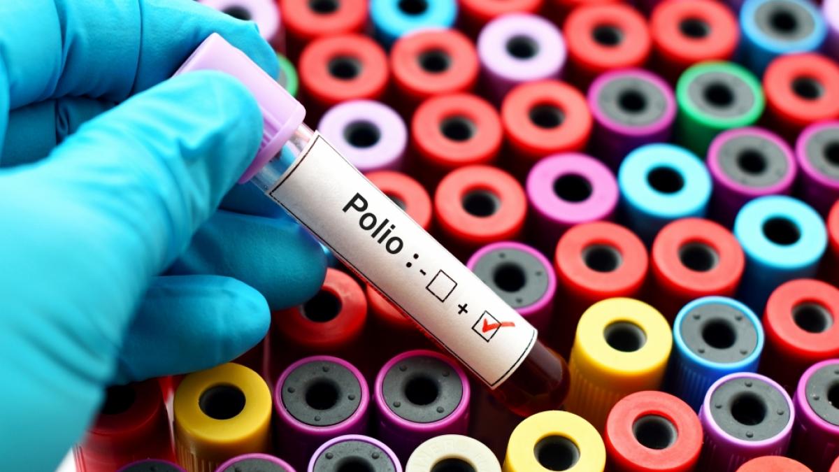 In Afrika ist ein Kind an Polio erkrankt. (Foto)