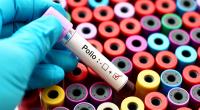 In Afrika ist ein Kind an Polio erkrankt.