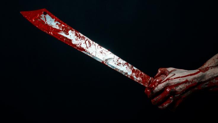 In Rheinland-Pfalz wurde einem 21-Jährigen die Hand mit einer Machete abgetrennt (Symbolbild).