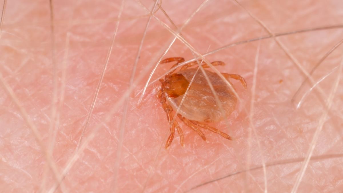 Zecken k&ouml;nnen das&nbsp;h&auml;morrhagische Krim-Kongo-Fieber &uuml;bertragen. (Symbolfoto) (Foto)