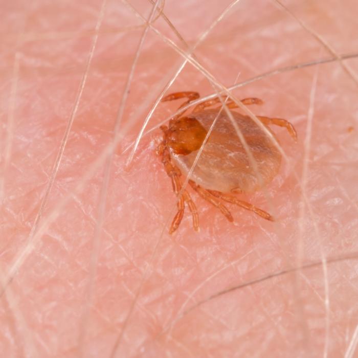 Forscher sind alarmiert! Tödliches Zecken-Virus auf dem Vormarsch