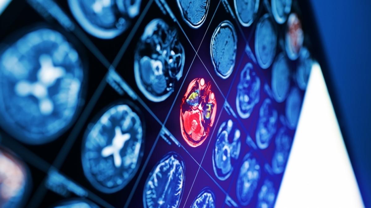 Kurz nach der Geburt ihres Kindes bekam Tr&ouml;delshow-Star Theo Burrell eine niederschmetternde Hirntumor-Diagnose - wie geht es der Expertin f&uuml;r Antiquit&auml;ten jetzt? (Foto)