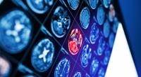 Kurz nach der Geburt ihres Kindes bekam Trödelshow-Star Theo Burrell eine niederschmetternde Hirntumor-Diagnose - wie geht es der Expertin für Antiquitäten jetzt?