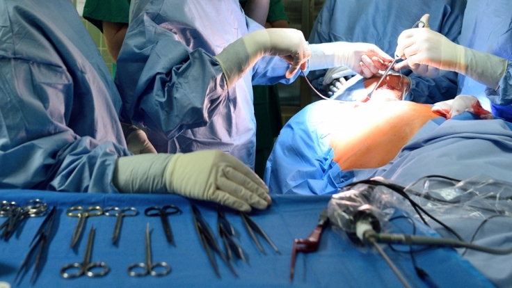 In Mexiko wurde einer Frau ein 34-Kilo-Tumor entfernt (Symbolbild).
