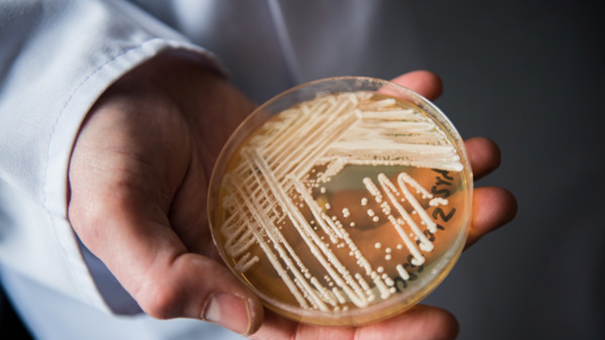 Der aggressive Hefepilz Candida auris gibt Medizinern Grund zur Sorge. (Foto)