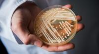 Der aggressive Hefepilz Candida auris gibt Medizinern Grund zur Sorge.