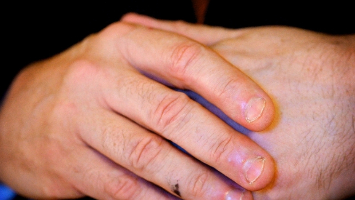 Experten halten das Fingerknacken f&uuml;r alles andere als einen harmlosen Tick. (Foto)