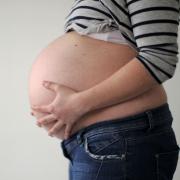 Die Chance für einen Uterus didelphys liegt bei 1:1.000.000.