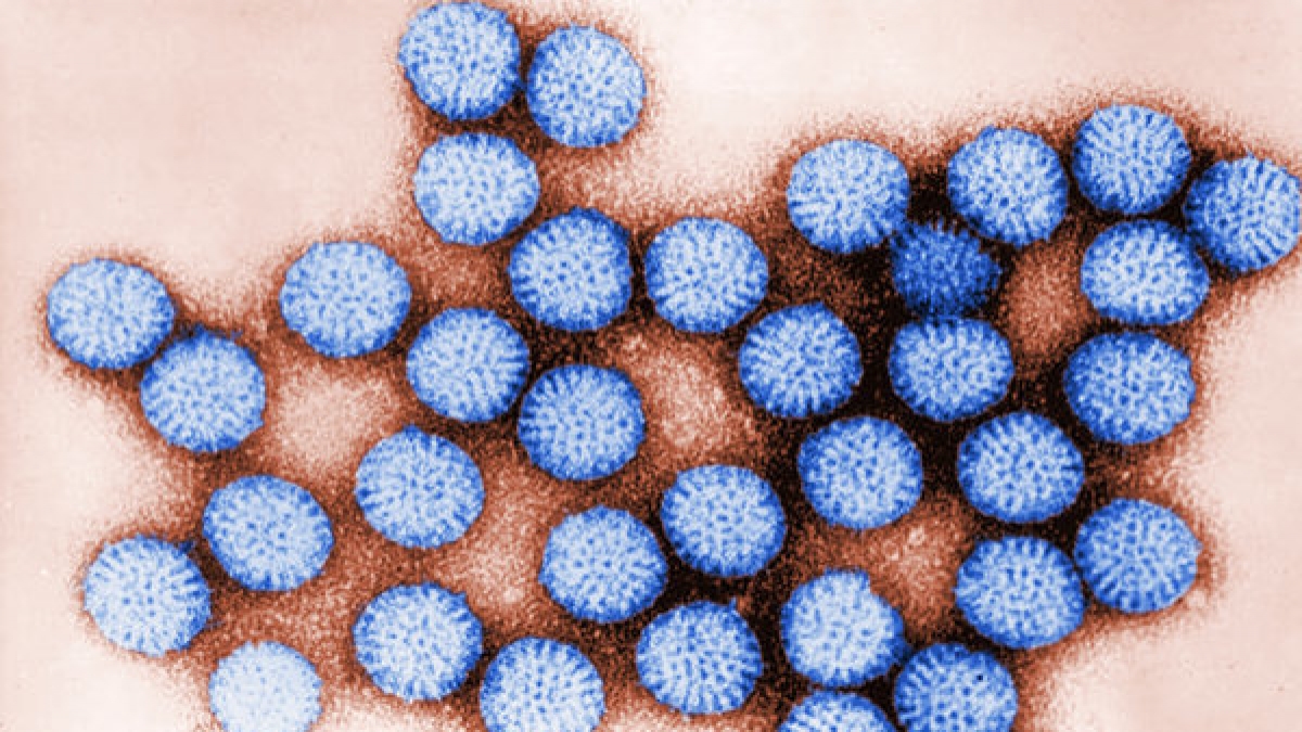 Das Rotavirus ist in Deutschland auf dem Vormarsch. (Foto)