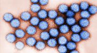Das Rotavirus ist in Deutschland auf dem Vormarsch.