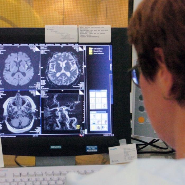 Amoklauf in den Blutgefäßen! DAS sind die Folgen des Gefäßrheumas