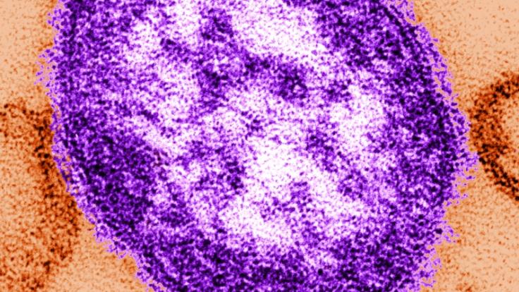 Eine Abbildung, die mit Hilfe eines Transmissionselektronenmikroskops gemacht wurde, zeigt Teile eines Masernvirus.
