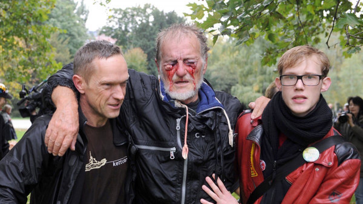 Er ist lebendes Symbol der Eskalation zwischen Stuttgart 21-Gegnern und der Polizei: Dietrich Wagner wird lebenslang auf einem Auge blind bleiben – durch den scharfen Strahl eines Wasserwerfers. (Foto)