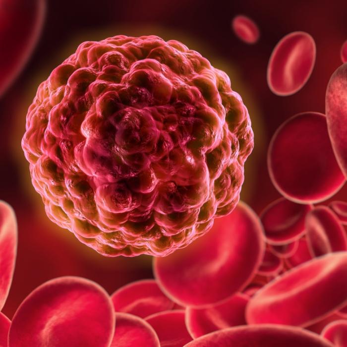 Therapie-Sensation! Düsseldorfer von HIV und Krebs geheilt