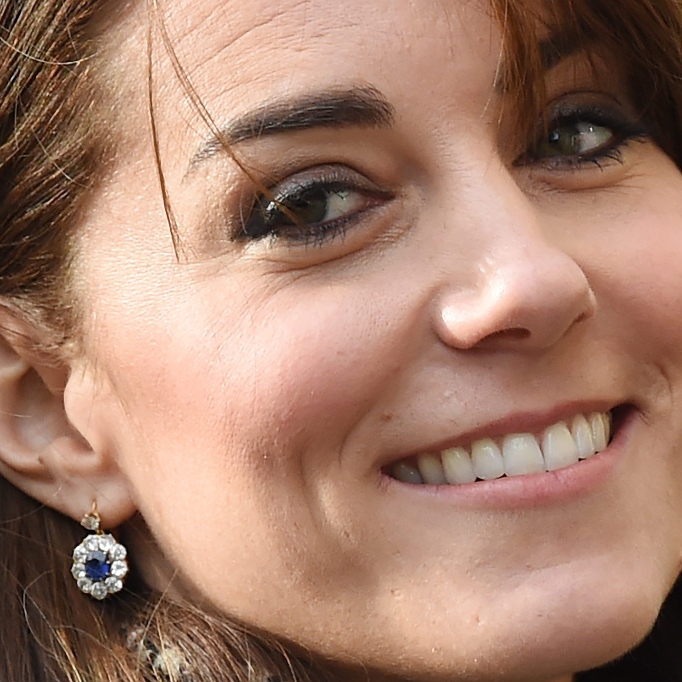 Braucht sie Botox? Herzogin Kate soll unters Messer