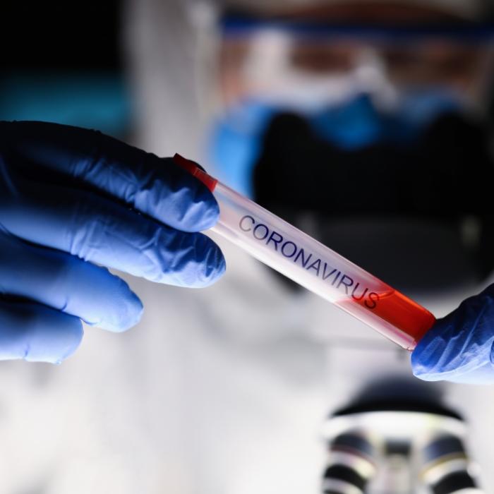 Ebola, Grippe, Krätze: DIESE Medikamente könnten Covid-19 heilen