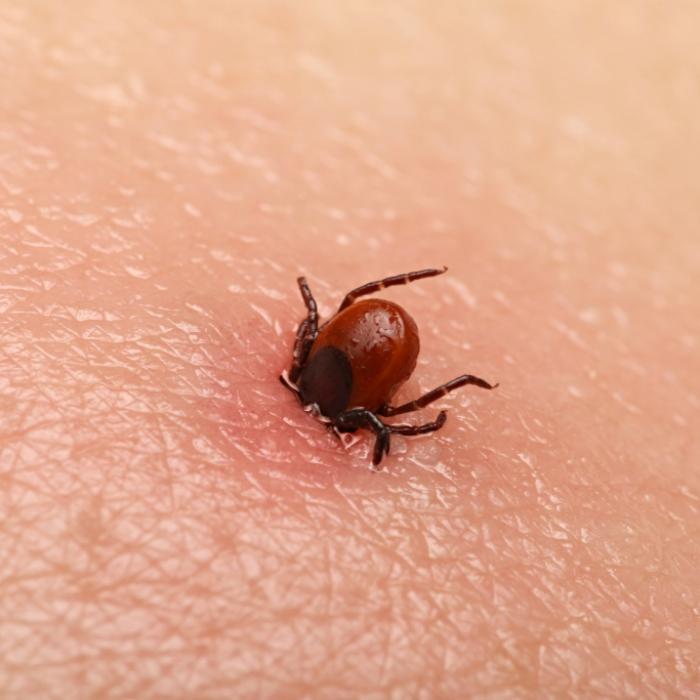 Erster Nachweis in Deutschland! So gefährlich ist das neue Zecken-Virus