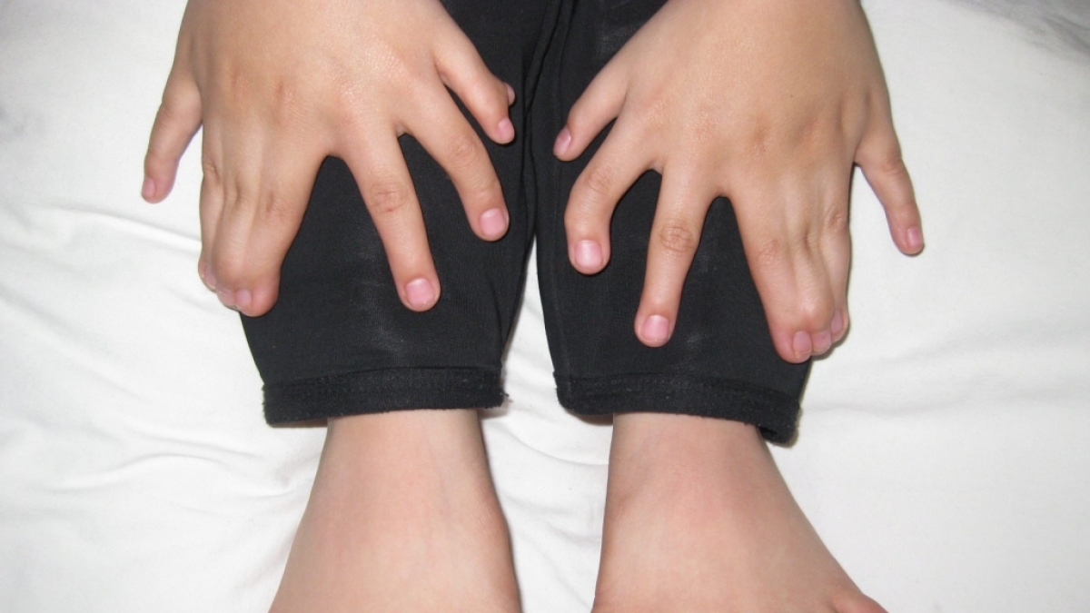 15 Finger, 16 Zehen: So viele Finger und Zehen wie bei diesem kleine Junge aus dem Nordosten Chinas wurden zuvor noch nie bei einem Menschen gezählt. (Foto)