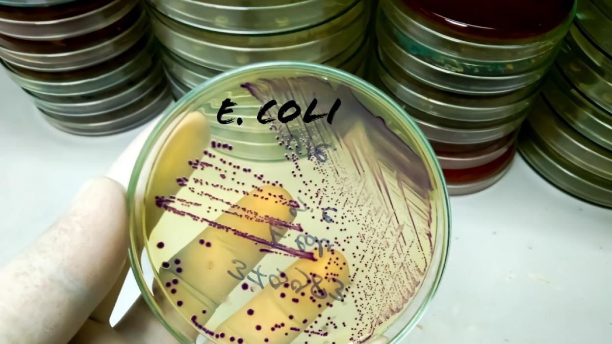 Eine neue e.coli-Variante besorgt schwedische Experten. (Symbolfoto) (Foto)