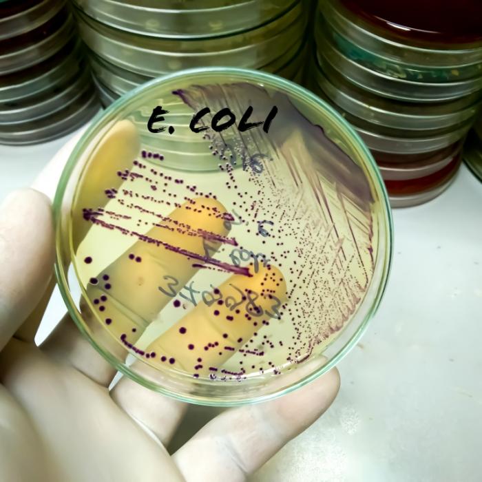 Antibiotika wirkt nicht - Experten zeigen sich besorgt