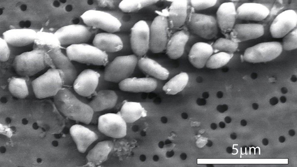 Die meisten Bakterien k&ouml;nnen in der Regel nur Menschen mit schwachem Immunsystem gef&auml;hrlich werden. (Foto)