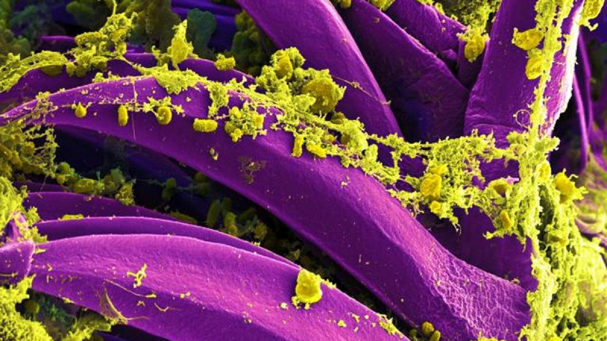 Der Pesterreger Yersinia pestis ist in vielen Teilen Kaliforniens pr&auml;sent, nun hat sich eine Person beim Camping mit dem Bakterium infiziert. (Foto)